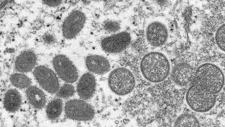 Monkeypox | Next viral disease?